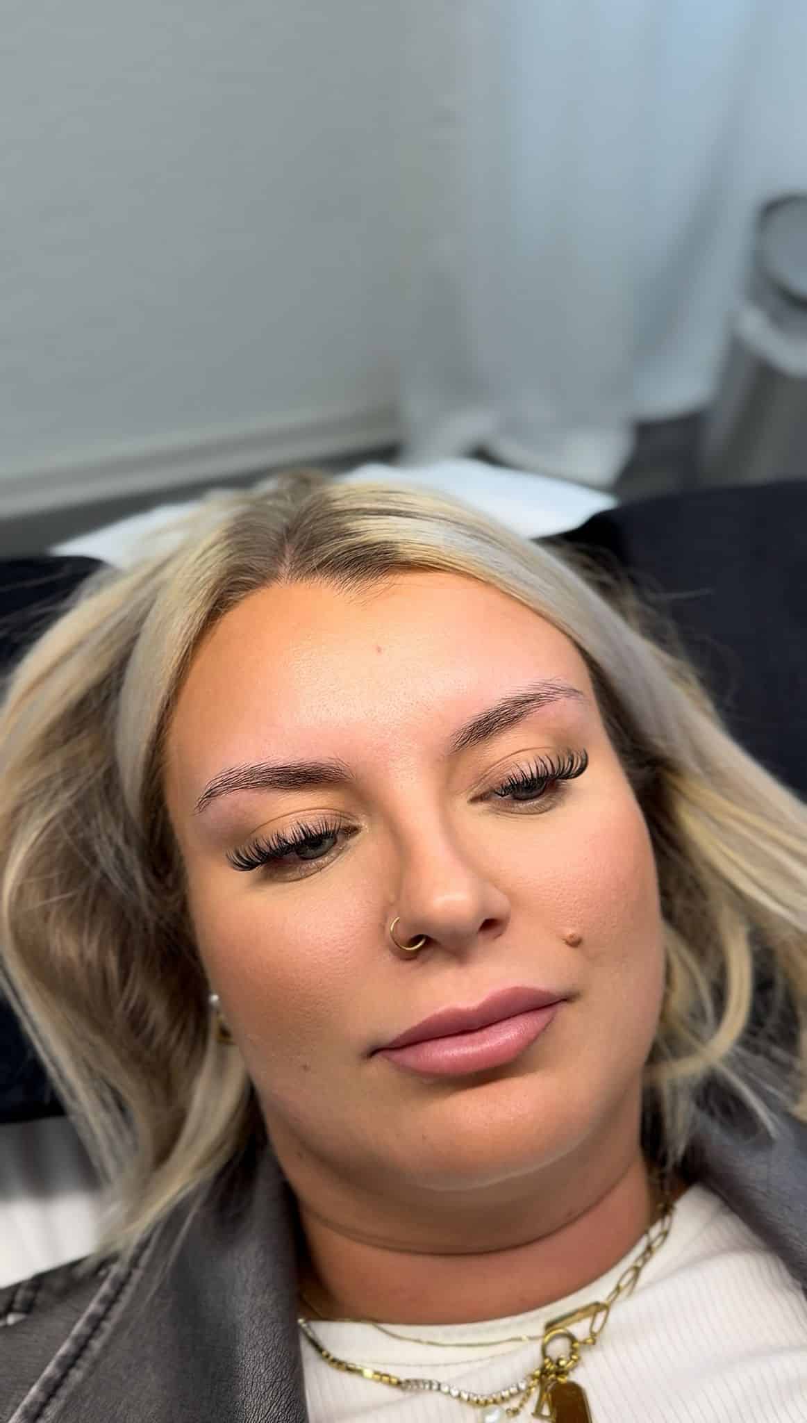 Vorher